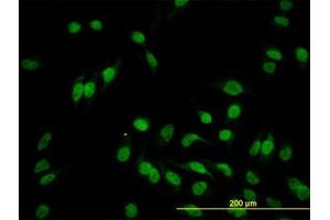 Image no. 3 for anti-Hairy/enhancer-of-Split Related with YRPW Motif-Like (HEYL) (AA 221-327) antibody (ABIN599209) (HEYL anticorps  (AA 221-327))