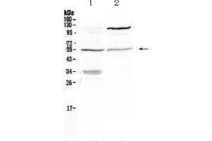 Western blot analysis of ETS1 using anti- ETS1 antibody . (ETS1 anticorps  (N-Term))