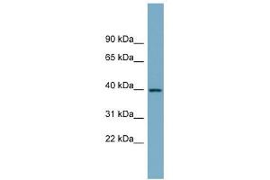 SULT2B1 antibody used at 1 ug/ml to detect target protein. (SULT2B1 anticorps  (N-Term))
