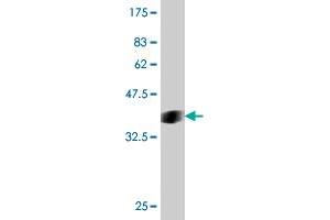 Western Blot detection against Immunogen (37.