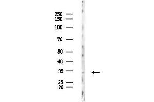 anti-Phosphoinositide-3-Kinase-Interacting Protein 1 (PIK3IP1) (N-Term) antibody