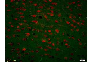 Formalin-fixed and paraffin-embedded rat brain labeled with Anti-CDK5 Polyclonal Antibody, Unconjugated (ABIN670101) 1:200, overnight at 4°C, The secondary antibody was Goat Anti-Rabbit IgG, Cy3 conjugated used at 1:200 dilution for 40 minutes at 37°C.