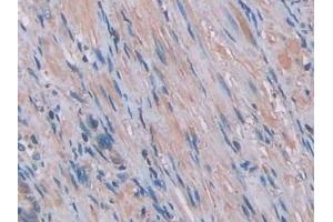 Detection of IL1a in Human Prostate Tissue using Monoclonal Antibody to Interleukin 1 Alpha (IL1a)