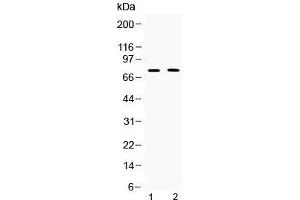 Western blot testing of 1) rat thymus and 2) human COLO320 lysate with TRF2 antibody at 0. (TRF2 anticorps)