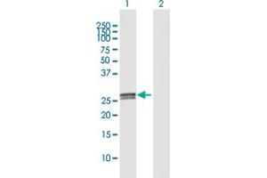 Western Blot analysis of C1QA expression in transfected 293T cell line by C1QA MaxPab polyclonal antibody.