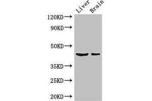Western Blot Positive WB detected in: Mouse liver tissue, Mouse brain tissue All lanes: METTL2A antibody at 3 μg/mL Secondary Goat polyclonal to rabbit IgG at 1/50000 dilution Predicted band size: 44, 28 kDa Observed band size: 44 kDa (METTL2A anticorps  (AA 1-242))