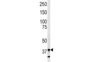 Western Blotting (WB) image for anti-Annexin A5 (ANXA5) (AA 262-291) antibody (ABIN3002694) (Annexin V anticorps  (AA 262-291))