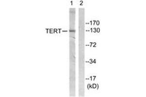 Western blot analysis of extracts from Jurkat cells, using Telomerase (Ab-824) Antibody. (TERT anticorps  (AA 796-845))