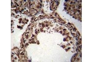 TUBA1C antibody immunohistochemistry analysis in formalin fixed and paraffin embedded human lung tissue.