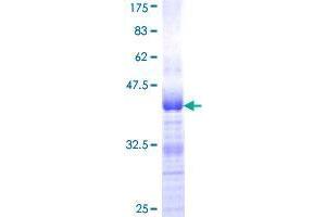 Autism Susceptibility Candidate 2 (AUTS2) (AA 108-198) protein (GST tag)