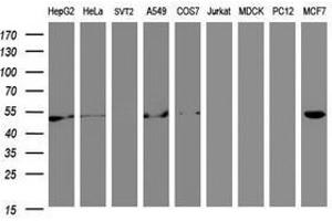 Image no. 6 for anti-Selenium Binding Protein 1 (SELENBP1) antibody (ABIN1500864) (SELENBP1 anticorps)