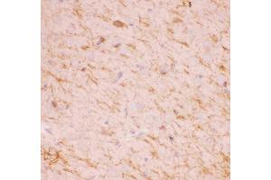 Anti-SIRT2 Picoband antibody,IHC(P): Mouse Brain Tissue