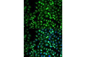 Immunofluorescence analysis of U2OS cell using GRM3 antibody.