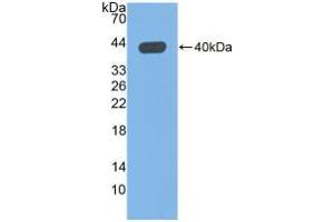 Western blot analysis of recombinant Human QPCT. (QPCT anticorps  (AA 29-361))