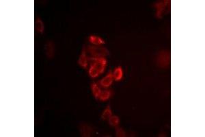 Immunofluorescent analysis of Connexin 40 staining in HepG2 cells.
