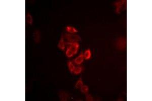 Immunofluorescent analysis of Connexin 40 staining in HepG2 cells. (Cx40/GJA5 anticorps)