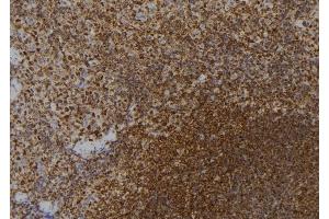 anti-Zinc Finger Protein 416 (ZNF416) antibody