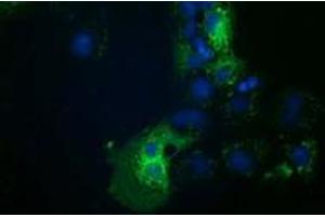 Anti-HDAC6 mouse monoclonal antibody (ABIN2454079) immunofluorescent staining of COS7 cells transiently transfected by pCMV6-ENTRY HDAC6 (RC209649). (HDAC6 anticorps)