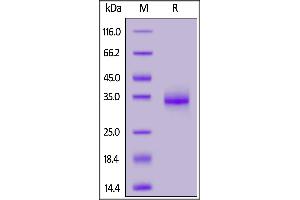 SARS-CoV-2 S protein RBD (E484K), His Tag on  under reducing (R) condition.