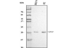 Western blot analysis of P19 INK4d/CDKN2D using anti-P19 INK4d/CDKN2D antibody (ABIN7601248).