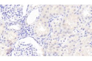 Detection of TSLP in Human Kidney Tissue using Polyclonal Antibody to Thymic Stromal Lymphopoietin (TSLP) (Thymic Stromal Lymphopoietin anticorps  (AA 29-159))