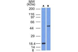 Western blot testing of A) partial recombinant protein B) A375 cell lysate using SOX10 antibody (SOX10/991). (SOX10 anticorps  (AA 115-269))