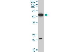 EBF3 monoclonal antibody (M06), clone 1G3. (EBF3 anticorps  (AA 381-480))
