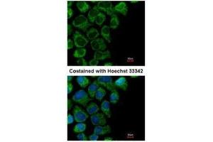 ICC/IF Image Immunofluorescence analysis of methanol-fixed A431, using OAT, antibody at 1:200 dilution. (OAT anticorps)