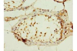 Immunohistochemistry of paraffin-embedded human testis tissue using ABIN7174888 at dilution of 1:100 (C7orf61 anticorps  (AA 1-206))
