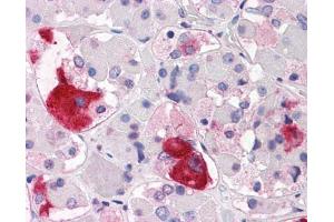 Anti-CRHR2 antibody IHC of human brain, pituitary.