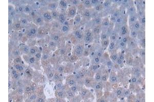 Detection of Slit3 in Mouse Liver Tissue using Polyclonal Antibody to Slit Homolog 3 (Slit3)