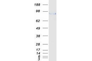 Validation with Western Blot