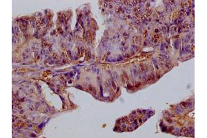 Immunohistochemistry of paraffin-embedded human adrenal gland tissue using ABIN7152940 at dilution of 1:100 (FIL1L anticorps  (AA 1-200))