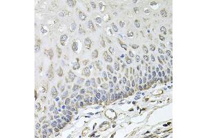 Immunohistochemistry of paraffin-embedded human esophagus using RHOT1 antibody (ABIN5973450) at dilution of 1/100 (40x lens).
