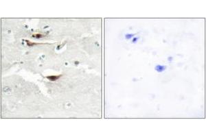 Immunohistochemistry analysis of paraffin-embedded human brain tissue, using IPPK Antibody.