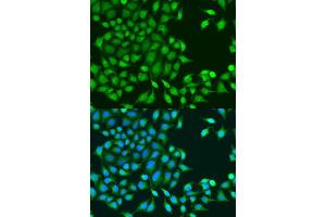anti-RuvB-Like 1 (E. Coli) (RUVBL1) (AA 1-214) antibody