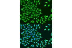 Immunofluorescence analysis of U2OS cells using RUVBL1/TIP49A/PONTIN antibody (ABIN6132606, ABIN6147318, ABIN6147320 and ABIN6218477) at dilution of 1:100. (RUVBL1 anticorps  (AA 1-214))