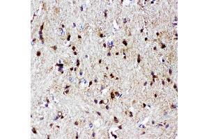 Anti-p73 antibody, (ABIN3043469), IHC(P)IHC(P): Rat Brain Tissue