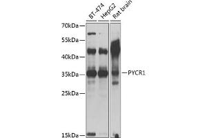 Western blot analysis of extracts of various cell lines, using PYCR1 antibody (ABIN6133043, ABIN6146517, ABIN6146519 and ABIN6217304) at 1:1000 dilution. (PYCR1 anticorps  (AA 1-319))