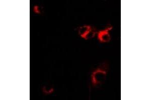 Immunofluorescent analysis of IL-1RA staining in MCF7 cells.