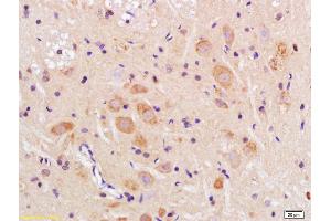 Formalin-fixed and paraffin embedded rat brain labeled with Anti-TMEM158 Polyclonal Antibody, Unconjugated (ABIN1386582) at 1:200 followed by conjugation to the secondary antibody and DAB staining (TMEM158 anticorps  (AA 188-260))