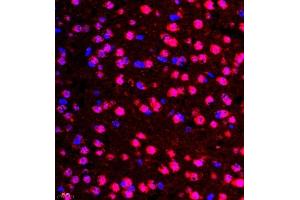 Immunofluorescence of paraffin embedded mouse brain using CSF1 (ABIN7073553) at dilution of 1:900 (400x lens)