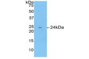 Detection of Recombinant CTSB, Human using Polyclonal Antibody to Cathepsin B (CTSB) (Cathepsin B anticorps  (AA 129-333))