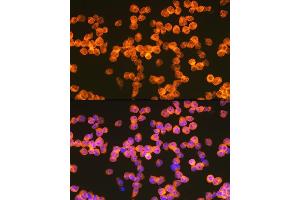 Immunofluorescence analysis of Jurkat cells using Z Rabbit mAb (ABIN7271430) at dilution of 1:100 (40x lens). (ZAP70 anticorps)
