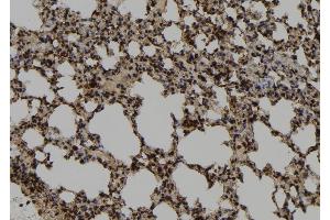 ABIN6273042 at 1/100 staining Mouse lung tissue by IHC-P.