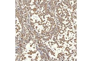IHC analysis of TST using anti-TST antibody (ABIN7599105). (TST anticorps  (AA 1-220))