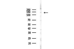 Western blot analysis of lysates from Hela cells(LPS, 4h treatment), using FGFR2 Antibody at 1/1000 dilution.