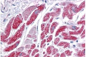 anti-Isocitrate Dehydrogenase 2 (NADP+), Mitochondrial (IDH2) (AA 354-452) antibody