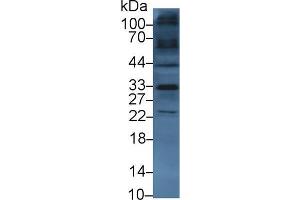 Western blot analysis of Mouse Heart lysate, using Human TKA1 Antibody (3 µg/ml) and HRP-conjugated Goat Anti-Rabbit antibody ( (SLC9A3R2 anticorps  (AA 56-326))