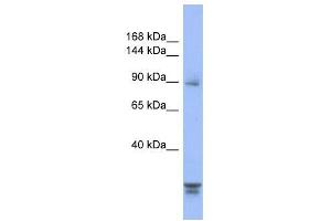 PPP2R3A antibody used at 1 ug/ml to detect target protein. (PPP2R3A anticorps)